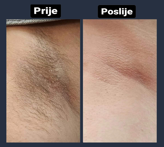 IVANA-BAUTY-HEALTH-GALERIJA-6